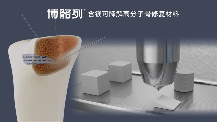 国内3D打印骨缺损修复材料换挡提速，激活骨科领域“加速带”